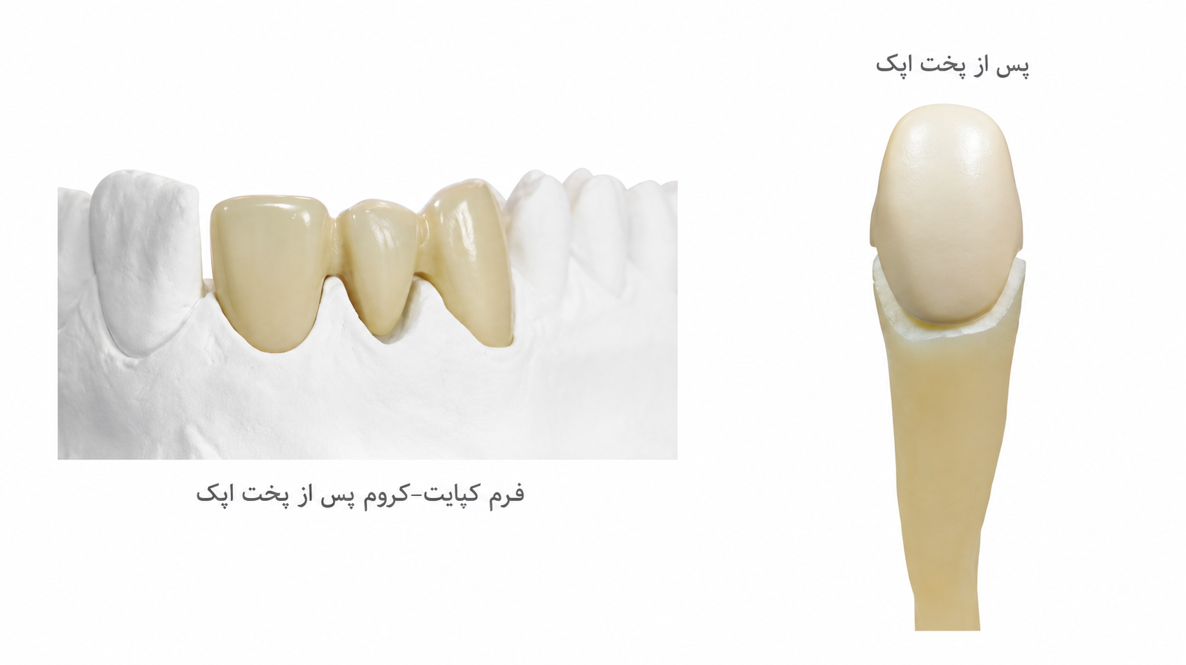 پودر اپک PFM افرند
