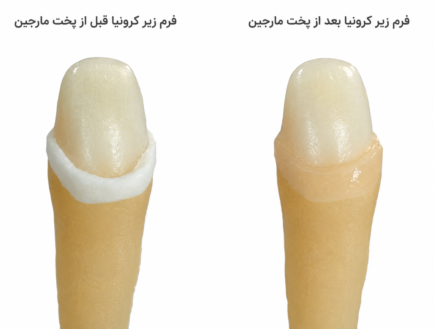 پودر مارجین PFM افرند